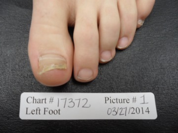 http://countryfootcare.com/wp-content/uploads/2015/02/17372-L1BEFORE.jpg