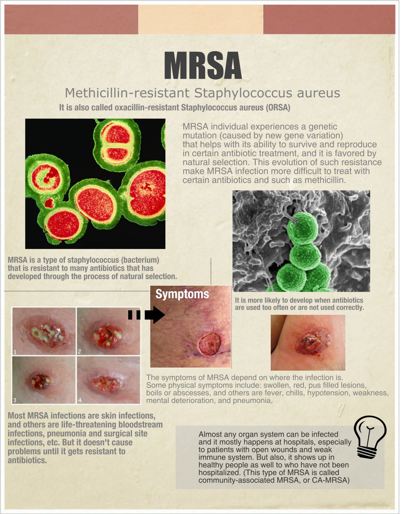 MRSA diagram