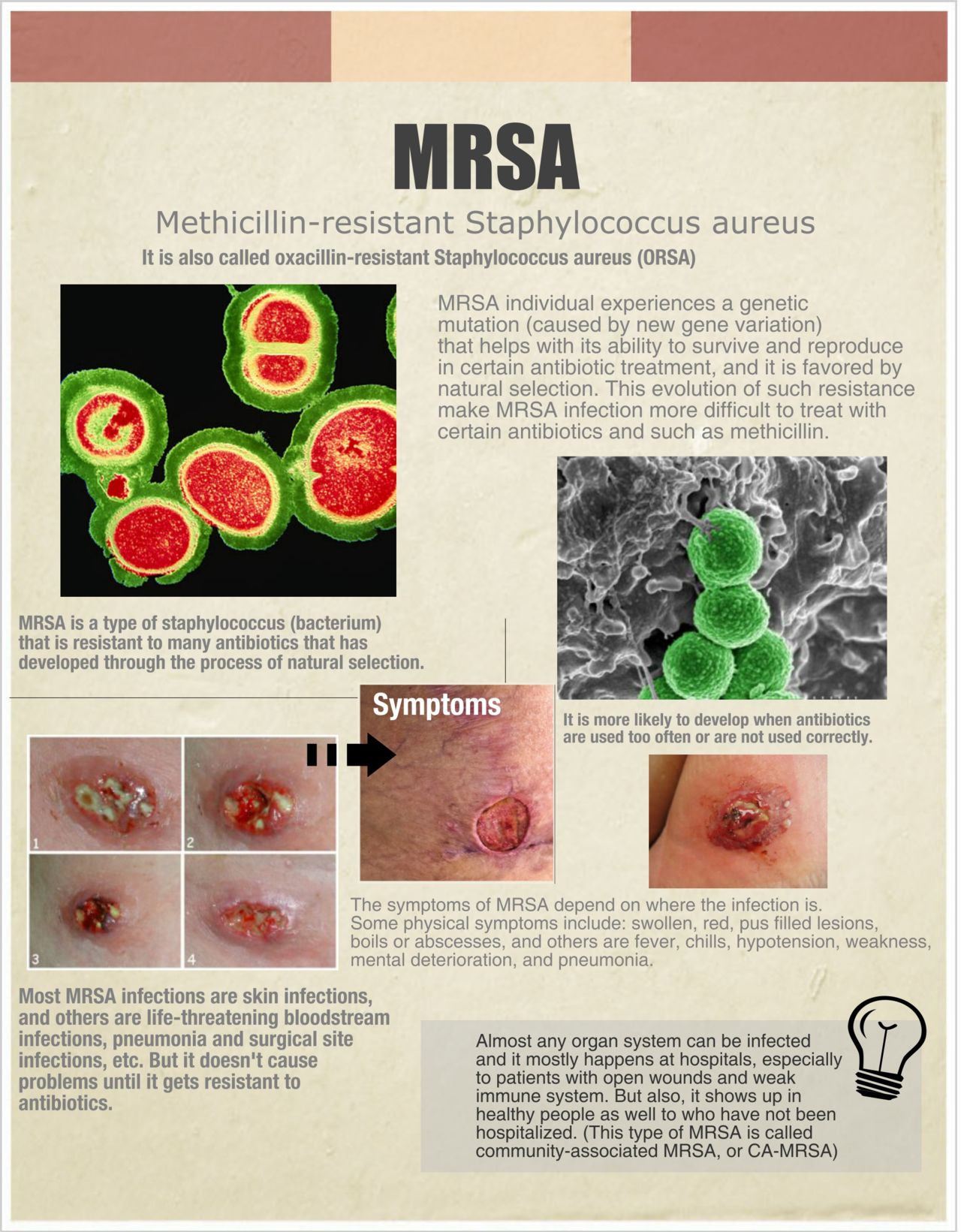 Mrsa