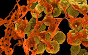 Methicillin resistant Staphylococcus aureus (MRSA) Bacteria